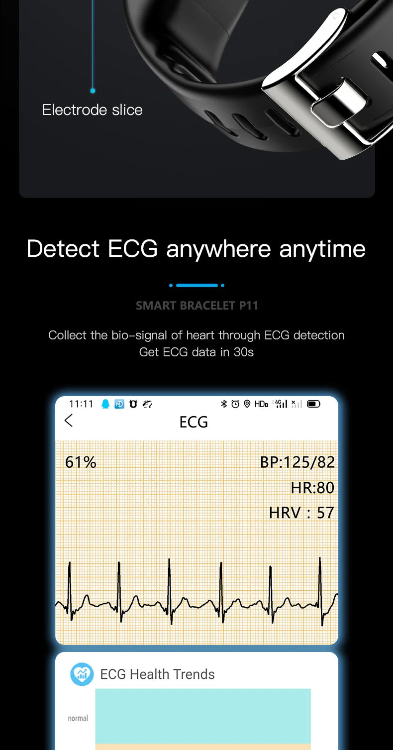 Nexora ECG1 Health Wristband