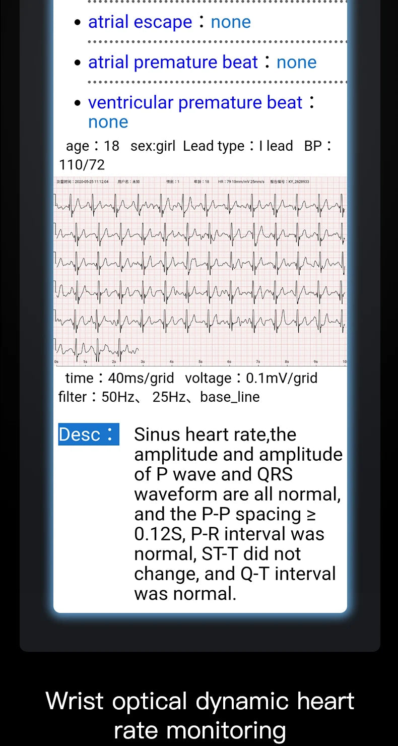Nexora ECG1 Health Wristband